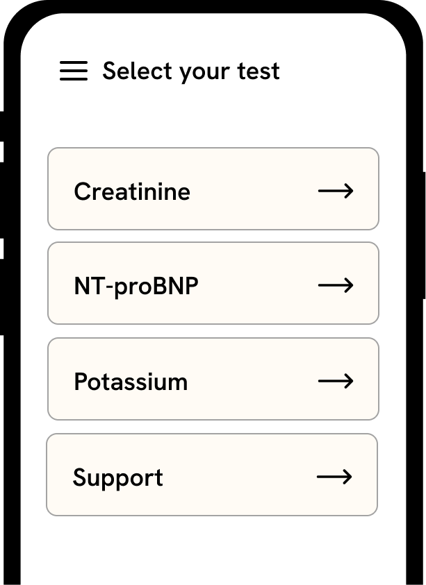 Select test UI